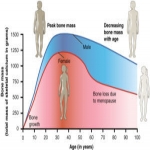 Bone Density Test - Do you have Peanut Butter Bone?