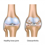 Cartilage: The tread to our tires