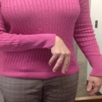 Dr. Atul Patel Discusses Treatments For Spasticity