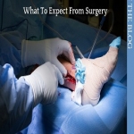 Lateral Ligament Reconstruction Surgery