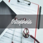 Osteoporosis and Treatment