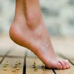 Plantar Fasciitis