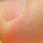 The dreaded hangnails and how to prevent them