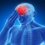 Treating Post-Concussion Syndrome